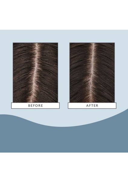 Scalp Revival 177 Ml