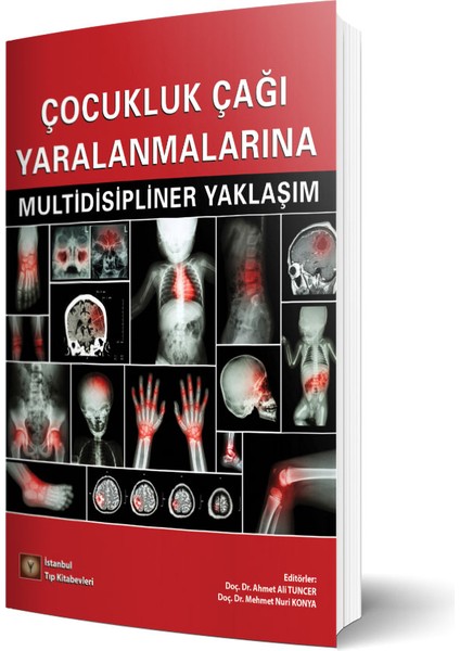 Çocukluk Çağı Yaralanmalarına Multidisipliner Yaklaşım
