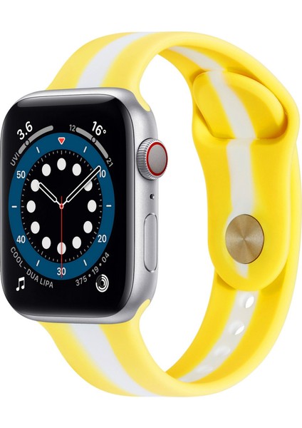 Zszh Apple Watch Için Aksesuar (Yurt Dışından)