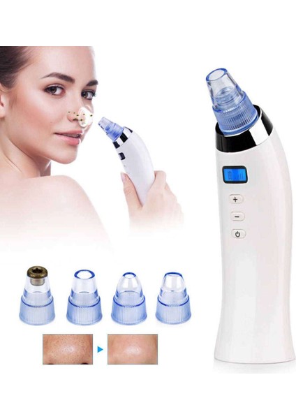 Xn 8030 Beautiful Skin Care Expert Şarjlı Vakumlu Siyah Nokta Cilt Temizleyici Yüz Temizleme Cihazı fiyatları