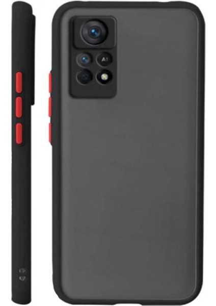 Xiaomi Poco X4 Pro 5g London Serisi Darbeye Dayanıklı Kılıf - Buzlu Siyah