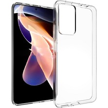 Kılıfist Xiaomi Redmi Note 11 Pro 5g Kılıf Clear Soft Transparent Şeffaf Ince Silikon + Ekran Koruyucu