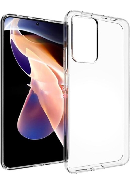 Xiaomi Redmi Note 11 Pro Plus 5g Kılıf Clear Soft Transparent Şeffaf Ince Silikon + Ekran Koruyucu