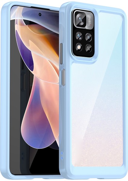 Xiaomi Poco X4 Nfc 5g Için Renkli Serisi Akrilik Kılıf (Yurt Dışından)