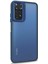 Xiaomi Redmi Note 11S Kılıf Bright Planet Lacivert 2