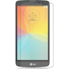 Canpay Lg L Bello Uyumlu Ekran Koruyucu Yeni Nesil‬ Yüksek Kalite Hd Cam