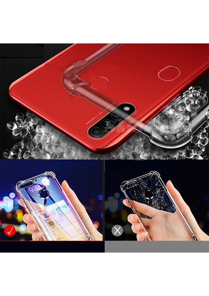 Oppo A31 Uyumlu Kılıf Case, Şeffaf Ultra Koruma Hard Transparent Ultra Protected