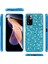 Xiaomi Redmi Için Glitter Powder Tpu Kılıfı Not 11S Altın (Yurt Dışından) 3