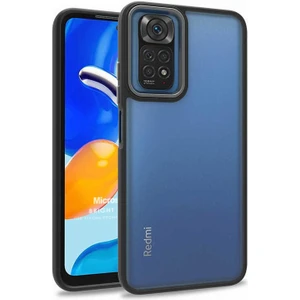 Xiaomi Redmi Note 11S Kılıf Bright Planet Siyah