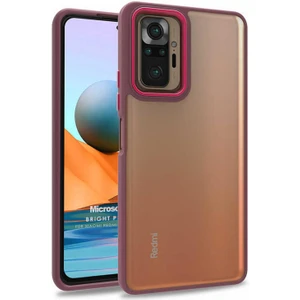 Xiaomi Redmi Note 10 Pro Max Kılıf Bright Planet Kırmızı