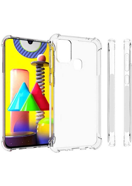 Samsung Galaxy M31 Uyumlu Kılıf Case, Şeffaf Ultra Koruma Hard Transparent Ultra Protected fiyatları