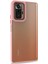 Xiaomi Redmi Note 10 Pro Kılıf Bright Planet Rose Gold 2