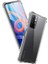 Xiaomi Redmi Note 11T 5g Uyumlu Kılıf Case, Şeffaf Ultra Koruma Hard Transparent Ultra Protected 1
