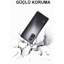 Case World Xiaomi Redmi Note 11S Global ile Uyumlu Kapak Kamera Korumalı Şeffaf Airbag Antishock Köşe Korumalı Silikon ile Uyumlu Kılıf