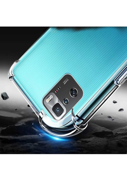 Xiaomi Poco X3 Uyumlu Kılıf Case, Şeffaf Ultra Koruma Hard Transparent Ultra Protected