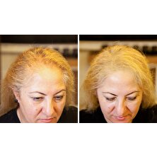 Fixplant 2 Şişe 56 gr ( Saç Gürleştirici, Saç Dolgunlaştırıcı, Saç Fiberi, Saç Tozu )