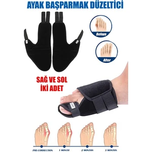 Ayak Başparmak Kemiği Çıkıntısı Bunyonu Düzeltici Halluks Vallgus Ayak Sağlığı Ateli 1 Çift