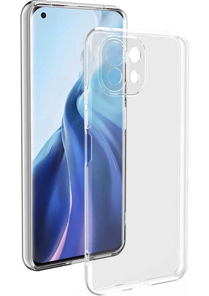 Xiaomi Mi 11 Kamera Korumalı Süper Silikon Kılıf Kırılmaz Ekran Koruyucu