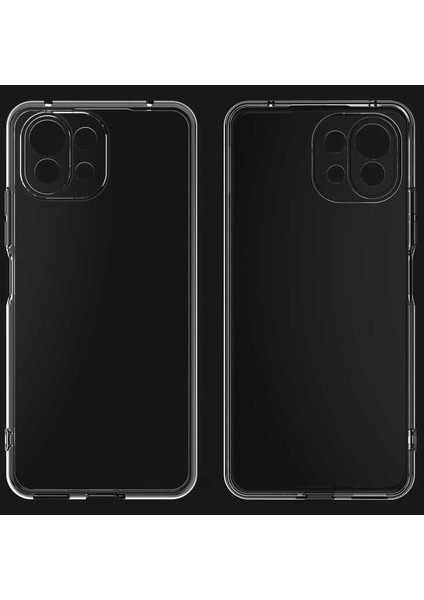 Xiaomi Mi 11 Lite Kamera Korumalı Süper Silikon Kılıf Ekran Koruyucu indirimleri