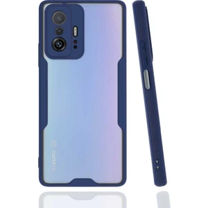 Xiaomi Mi 11T 5g Kılıf Arkası Mat Kamera Korumalı Silikon - Lacivert