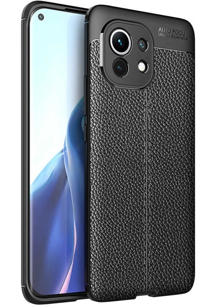 Xiaomi Mi 11 Kılıf Deri Dokulu Kamera Korumalı Silikon - Siyah