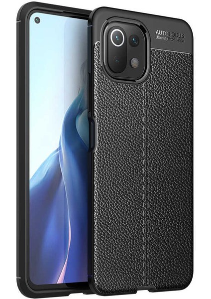 Xiaomi Mi 11 Lite Kılıf Deri Dokulu Kamera Korumalı Silikon - Siyah