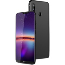 Microcase Huawei P20 Lite Elektrocase Serisi Silikon TPU Kılıf - Siyah