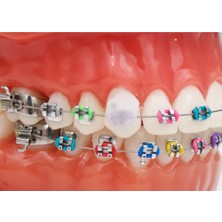 Dentalsepet Ortodonti Mumu - Diş Teli Mumu - Ortodontik Wax