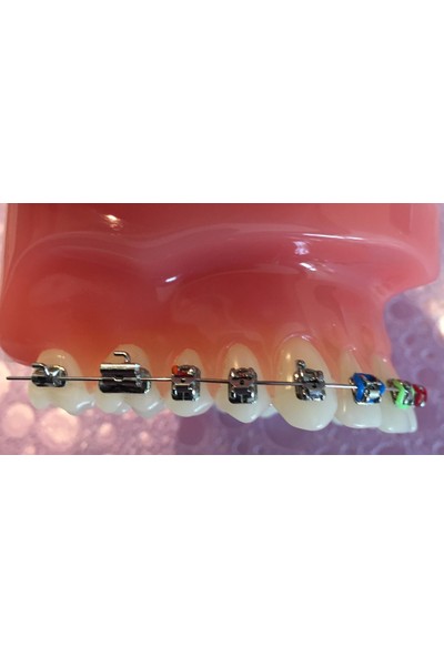 Dentalsepet Ortodonti Mumu - Diş Teli Mumu - Ortodontik Wax