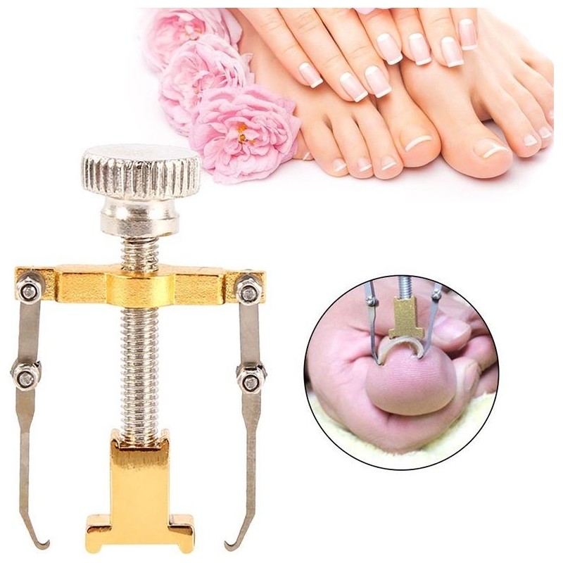 Nail Batık Batan Tırnak Sökme Aparatı Metal Kutusunda Hızlı Etki Gösteren Cihaz