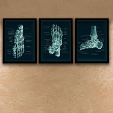 Anatomik Siyah Tablo, Ayak Kemikleri, Doktor Odası  Duvar Tablosu 3 Lü