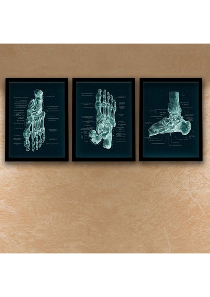 Anatomik Siyah Tablo, Ayak Kemikleri, Doktor Odası Duvar Tablosu 3 Lü