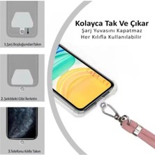 Activist Samsung Galaxy A33 5g Kılıf Ipli Boyun Askılı Baskılı Silikon - Unicorn4