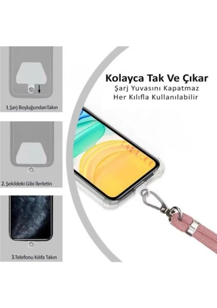 Samsung Galaxy A33 5g Kılıf Ipli Boyun Askılı Baskılı Silikon - Unicorn4