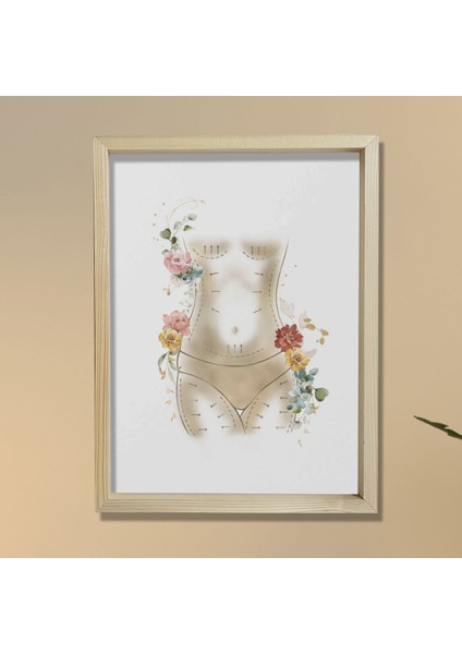 Anne Estetiği, Karın Germe, Liposuction, Plastik ve Estetik Cerrahı, Doktor Odası Duvar Tablosu