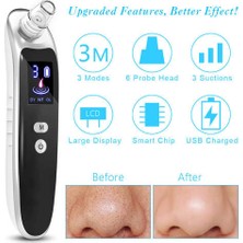 Sanlindou Yüz Spotları Kürek Ultrasonik Cilt Scrubber Blackhead Akne Sökücü Vakum Emme Temizleyici Pore Burun Asansör Extractor - Cilt Scrubber