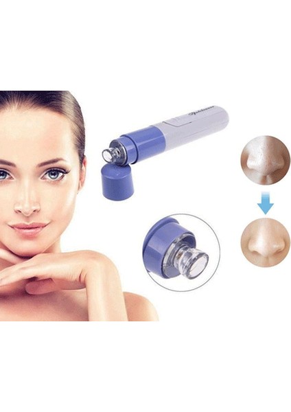 Pore Cleaner Yüz Temizleme Cihazı Vakumlu Siyah Nokta Temizleme Cihazı