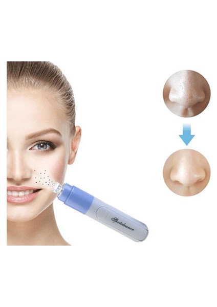 Pore Cleaner Yüz Temizleme Cihazı Vakumlu Siyah Nokta Temizleme Cihazı modelleri