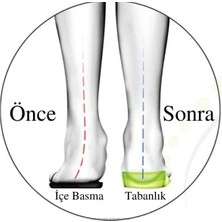 Karas Içe Basma Önleyici Ortopedik Jel Tabanlık