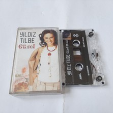 Bozmüzik Yıldız Tilbe Güzel Cam Baskı