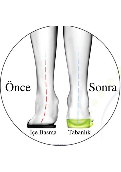 Içe Basma Önleyici Ortopedik Jel Tabanlık