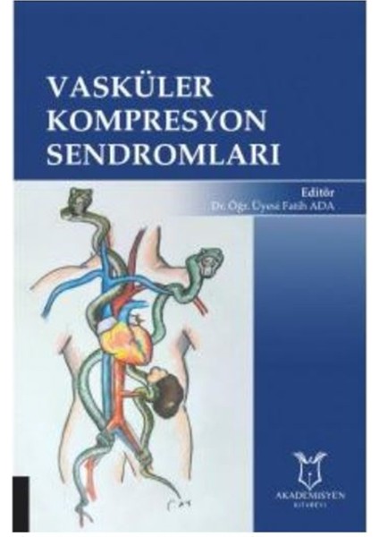 Vasküler Kompresyon Sendromları