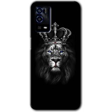 Bera Aksesuar Oppo A55 Kılıf Hd Desen Baskılı Arka Kapak - King Lion