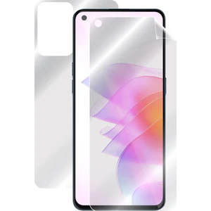 Ipg Oppo Reno 7 Tam Kaplama (Ekran ve Arka Koruma)