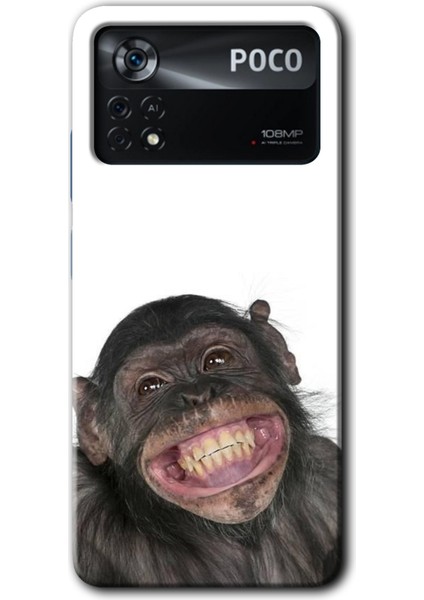 Poco X4 Pro Kılıf Hd Desen Baskılı Arka Kapak - Şıpsevdi Aşk