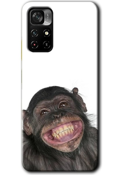 Poco M4 Pro 5g Kılıf Hd Desen Baskılı Arka Kapak - Şıpsevdi Aşk