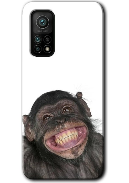 Xiaomi Mi 10T Kılıf Hd Desen Baskılı Arka Kapak - Şıpsevdi Aşk