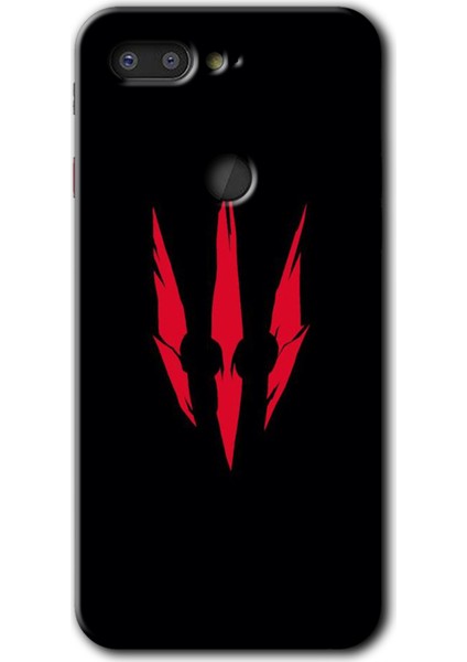 General Mobile Gm 9 Pro Kılıf Hd Desen Baskılı Arka Kapak - Ayı Pençesi
