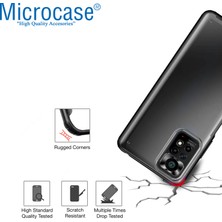 Microcase Xiaomi Redmi Note 11S Global 2022 Luna Serisi Köşe Korumalı Sert Rubber Kılıf - Siyah