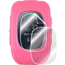 IPG Wiky Watch 1-Q50-U10 Akıllı Çocuk Saati Ekran Koruyucu (2 Adet)